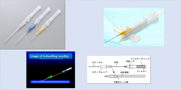 Indwelling needle